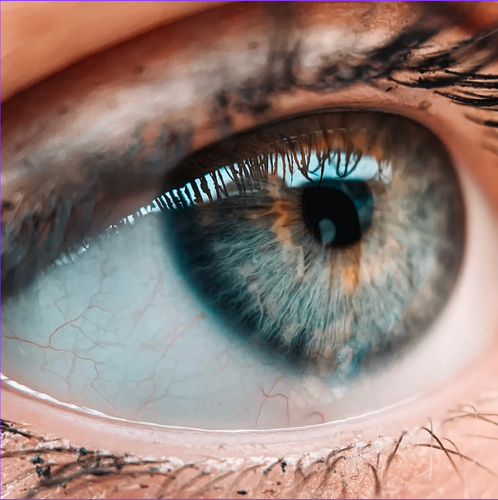 Eye