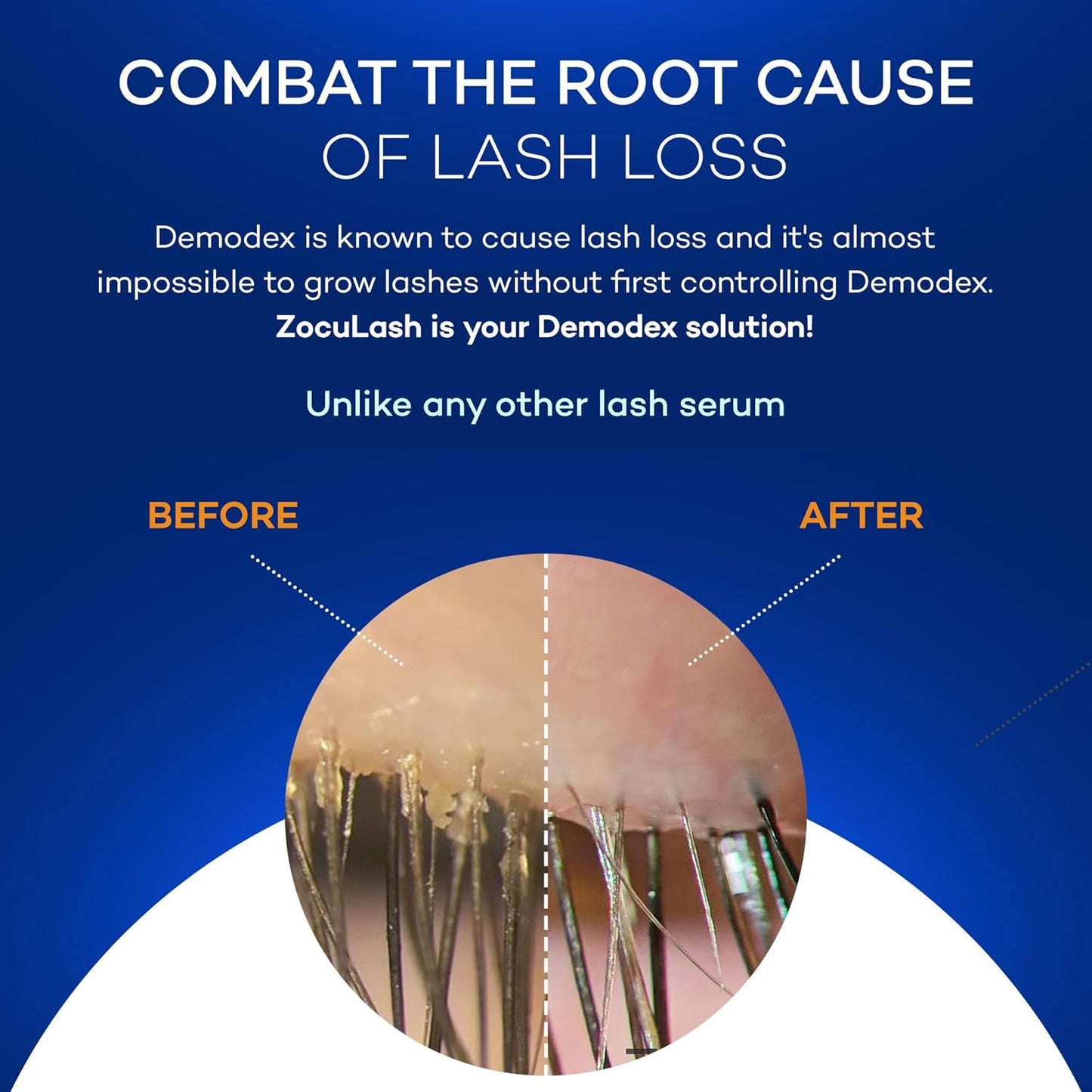 ZocuLash Eyelash Enhancing Serum (2.5ml)