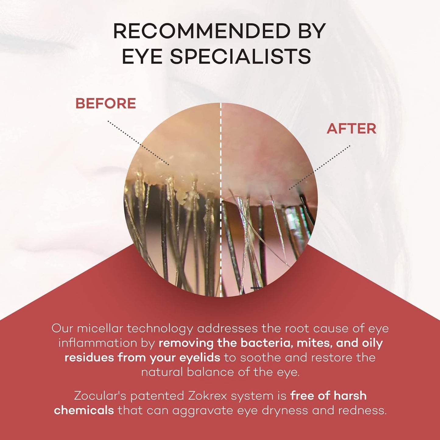 Zocushield Gel (10ml)