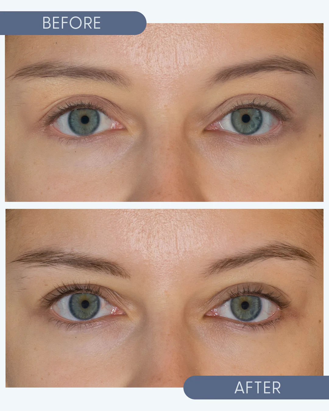 Growing Lash & Brow Serum (10ml)