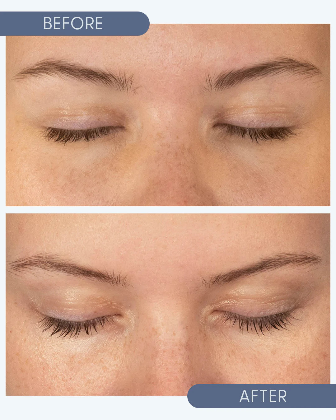 Growing Lash & Brow Serum (10ml)